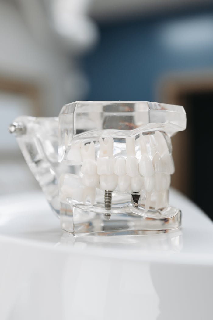 Transparent dental model showing teeth and implant screws, perfect for educational purposes.